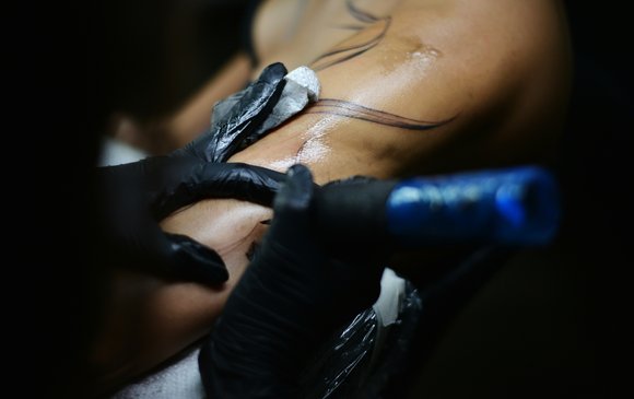 st-tattoo-bruising-body